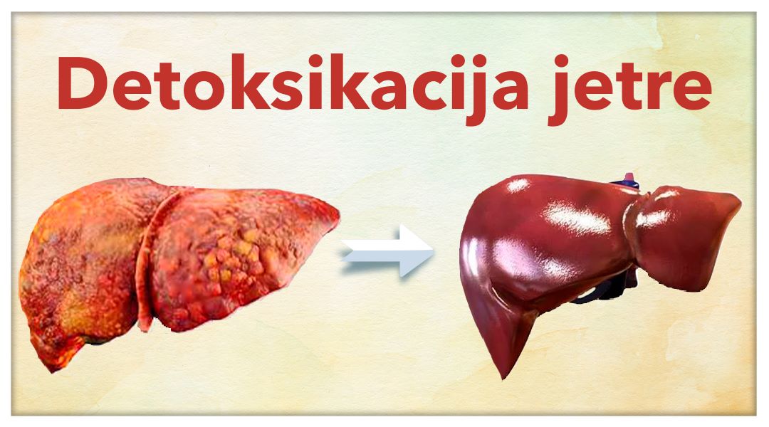 Detoksikacija